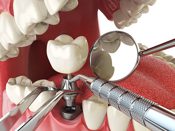 Best Emergency Dental Care for Sports Injuries in Mcguire Af, NJ
